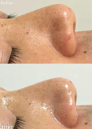 女性専門お顔剃り sunraineのエステ・リラクイメージ