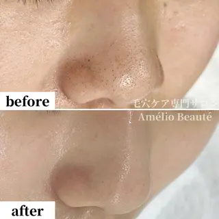 毛穴ケア専門サロン アメリオボーテのその他イメージ