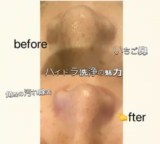 🧚‍♀️優来 リラク痩身肌質改善のエステ・リラクイメージ