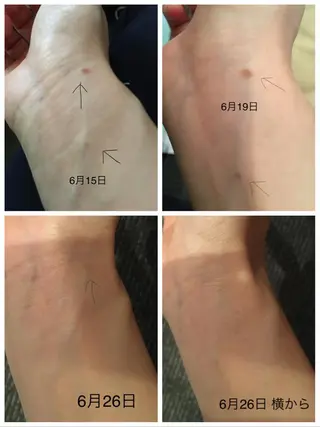 体質・肌質改善サロン アンシャンテのエステ・リラクイメージ