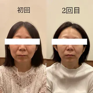 Hari Lounge恵比寿所属・chika🦋 ハリラウンジ恵比寿のエステ・リラクイメージ