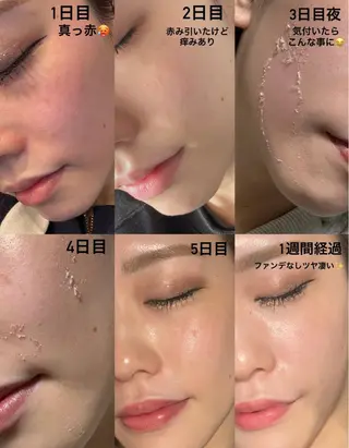 SHELLY 矢野のマツエク・マツパデザイン