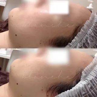 セミロング カラー パーマ ヘアアレンジ ネイル マツエク・マツパ アイブロウ 都度払い肌質改善 &脱毛Blancheのエステ・リラクイメージ