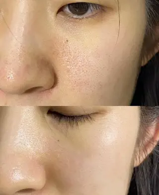 マツエク・マツパ aliaハーブ水光店 エステティシャン募集のエステ・リラクイメージ