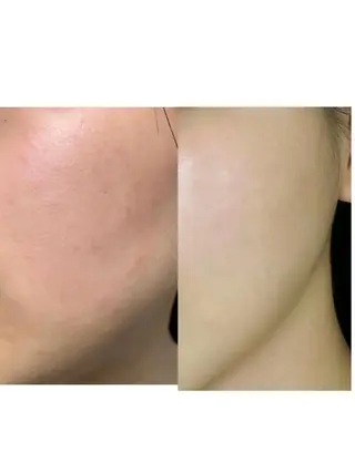 aliaハーブ水光店 エステティシャン募集のエステ・リラクイメージ