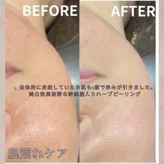 大橋 唯のエステ・リラクイメージ