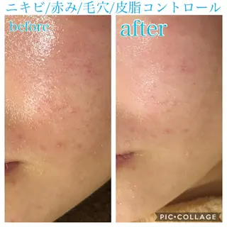 ロング カラー パーマ ヘアアレンジ キッズ ネイル マツエク・マツパ EnsorClair 代表 野口真央のエステ・リラクイメージ