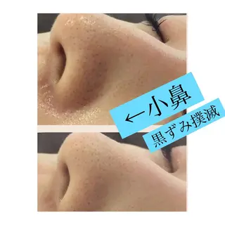 ショート カラー パーマ ヘアアレンジ メンズ キッズ ネイル マツエク・マツパ 金の糸脱毛 産毛ケア専門のエステ・リラクイメージ