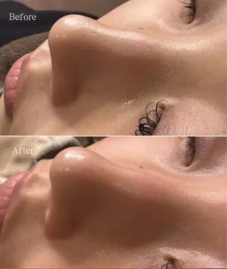 新宿大久保美容サロン BELL  マイのその他イメージ