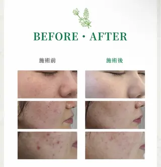 フルフィル名取美田園 MIYUKIのエステ・リラクイメージ