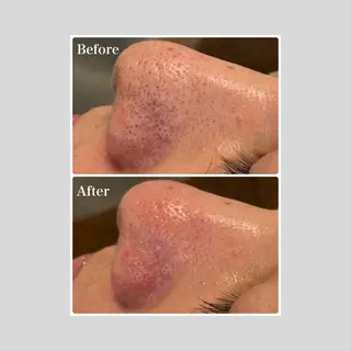 韓国肌管理 【毛穴専科】のエステ・リラクイメージ