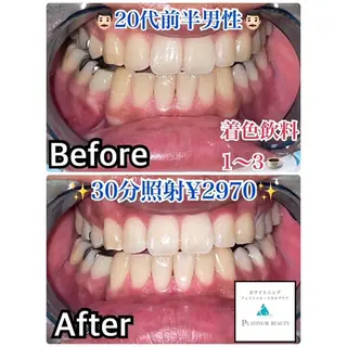 ホワイトニング ビューティー松戸店のその他イメージ