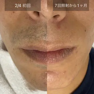 メンズ 港区都度払い脱毛 miranjuのエステ・リラクイメージ