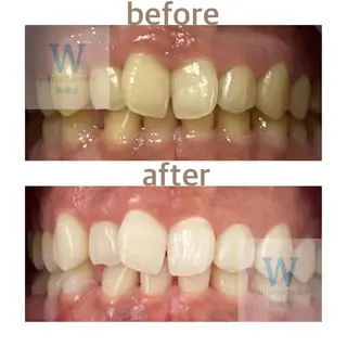 ホワイトニング ショップ船橋店🦷のエステ・リラクイメージ