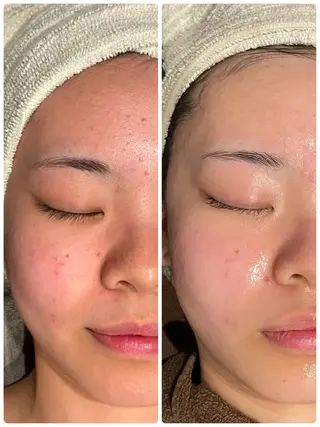 エステ／ネイル/脱毛 R.Msalonのネイルデザイン