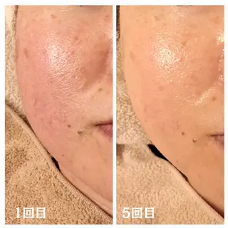 フェイシャル専門サロ ン　ERINのエステ・リラクイメージ