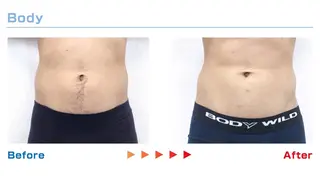 脱毛サロン moco selfのエステ・リラクイメージ