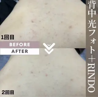 脱毛サロンALGO所属・美肌脱毛/ワックス ALGO高槻店のエステ・リラクイメージ