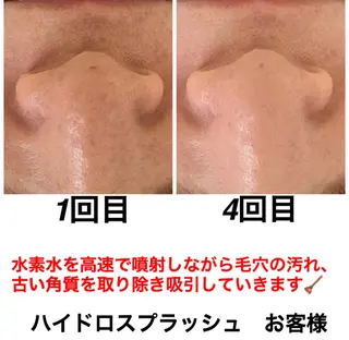 ネイル・エステサロン UILANIのネイルデザイン
