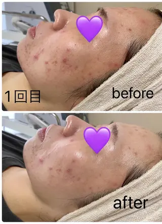 COCO beautyサロンのエステ・リラクイメージ