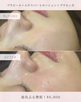 uni. beautyのエステ・リラクイメージ