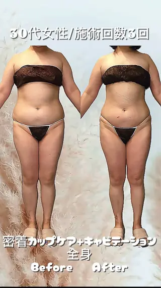 痩身・脱毛・肌管理 Rechica心斎橋のエステ・リラクイメージ