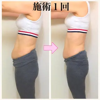 小顔モニター 募集のエステ・リラクイメージ