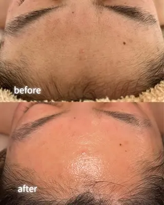 private beauty salon Lilby所属・リルビー 肌育・肌質改善サロンのその他イメージ