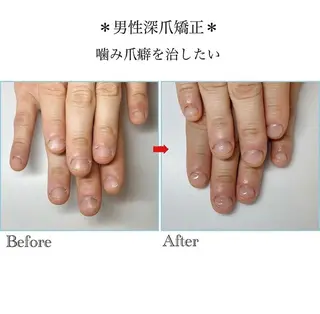 ネイル ネイルサロン アリュームのネイルデザイン