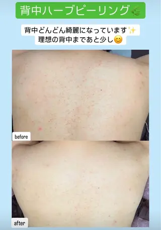 ベラージュ【美背中・ 美尻・フェイシャル】のエステ・リラクイメージ