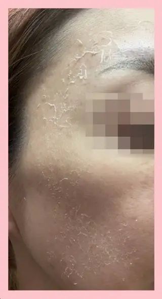 ハーブピーリング 専門店Kikkaのエステ・リラクイメージ