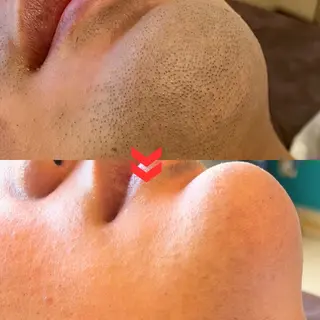 メンズ 都度払い制メンズ脱毛 オーナーのエステ・リラクイメージ