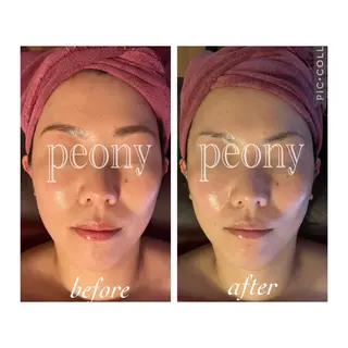 デトックス美容専門 サロンｐｅｏｎｙのエステ・リラクイメージ