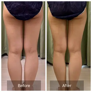 【元に戻らない】 小顔&部分痩せのその他イメージ