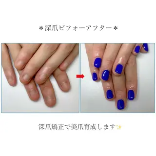 ネイル ネイルサロン アリュームのネイルデザイン