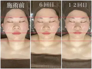 千歳の女神　久屋大通店所属・コルギと痩身の専門店 🌿✨堀江りなのエステ・リラクイメージ