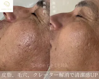 ハーブピーリング専門 サロンドレナ平岡のエステ・リラクイメージ