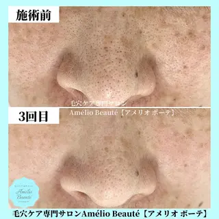 毛穴ケア専門サロン アメリオボーテのその他イメージ