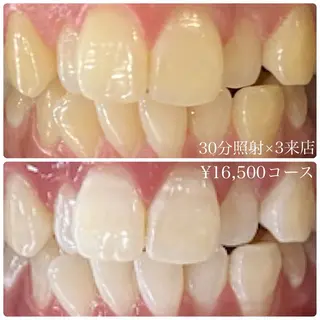 ホワイトニングルーム 横浜店のその他イメージ