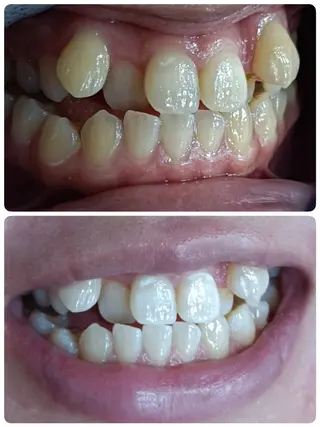 メンズ キッズ 美ろく　トータルビューティーサロン所属・セルフホワイトニング メーカー直営サロンのエステ・リラクイメージ