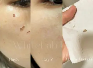 M渋谷店所属・M渋谷 ホワイトニングのエステ・リラクイメージ