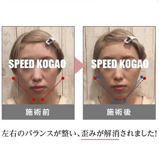 小顔矯正Speed KOGAO渋谷本店のエステ・リラクイメージ