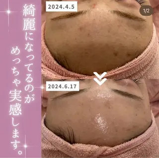 【現役看護師】高来 笑子のエステ・リラクイメージ