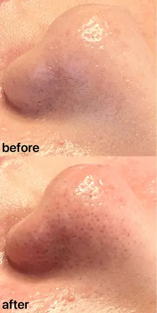 眉毛×小顔矯正サロン パピヨンsakiのエステ・リラクイメージ