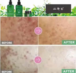 メンズ beauty salonnのエステ・リラクイメージ