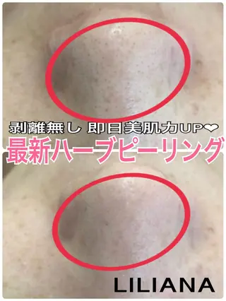 LILIANA ☆YURIのエステ・リラクイメージ