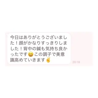 即小顔♥️美容鍼× ハーブピーリングのその他イメージ