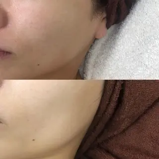 M渋谷 ホワイトニングのエステ・リラクイメージ