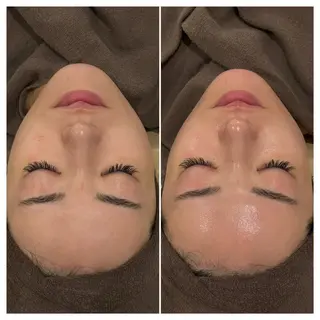 赤澤/本気痩せ・脱毛 ・ノーファンデ肌のエステ・リラクイメージ