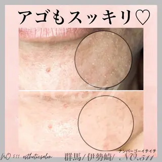 脱毛&フェイシャル NO.511のエステ・リラクイメージ